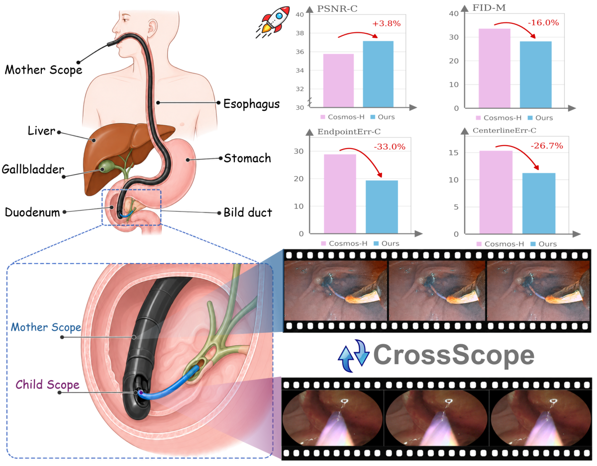 CrossScope overview: Mother and Child scopes, directional evidence routing, and prediction gains.