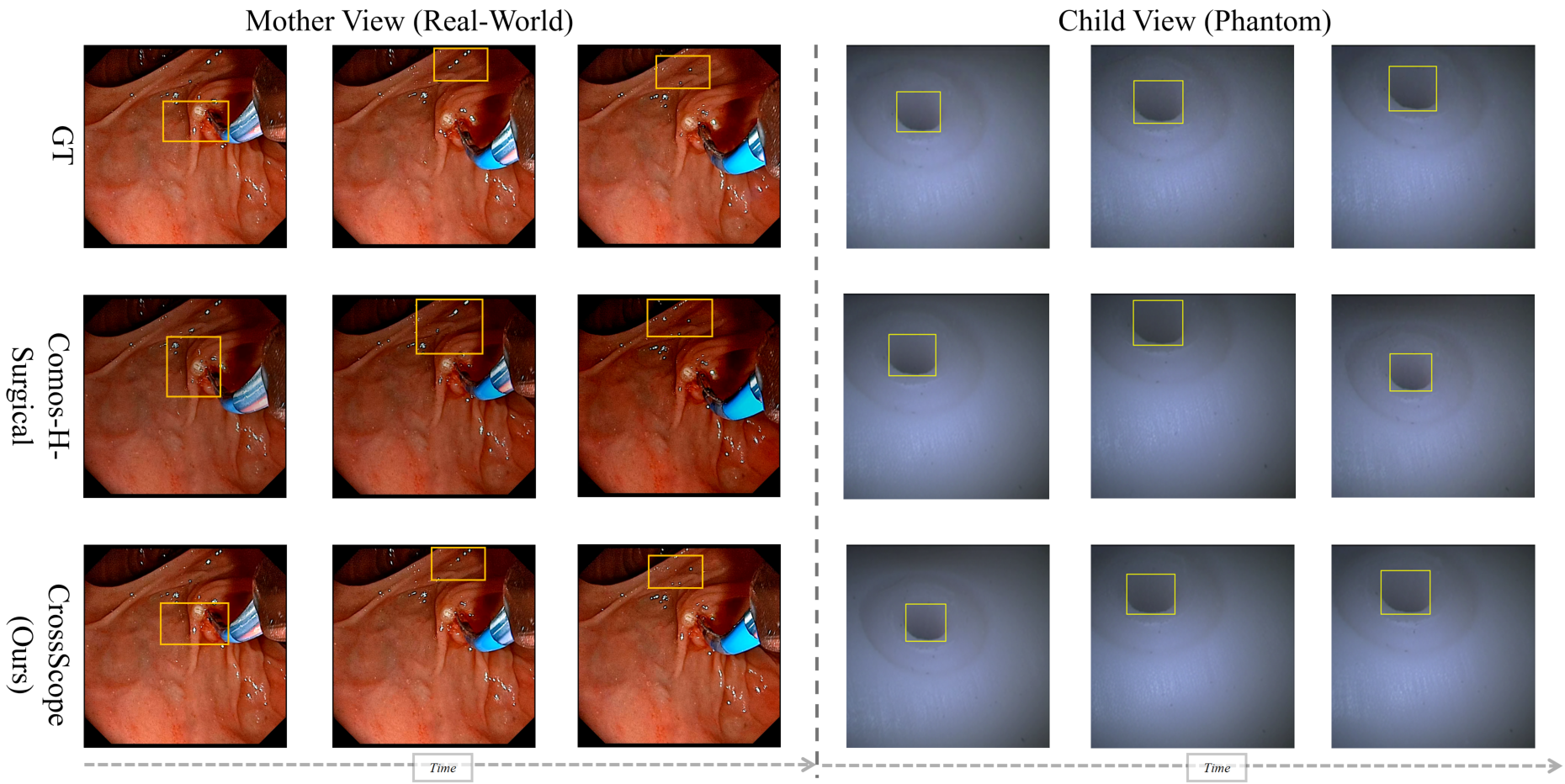 CrossScope qualitative prediction comparison across Mother and Child views.