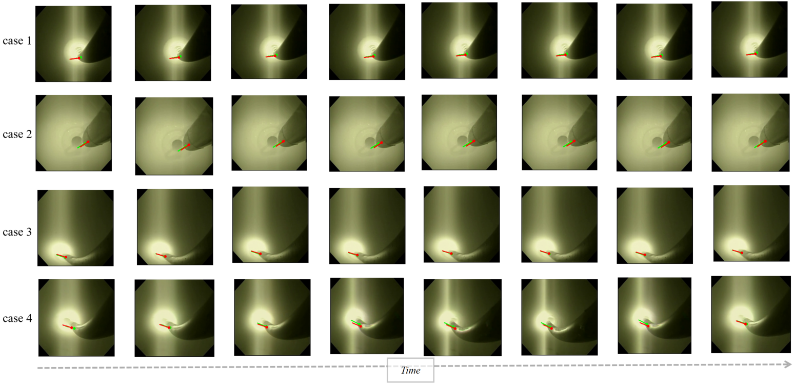 Pose signal used to align the dual-scope routing.