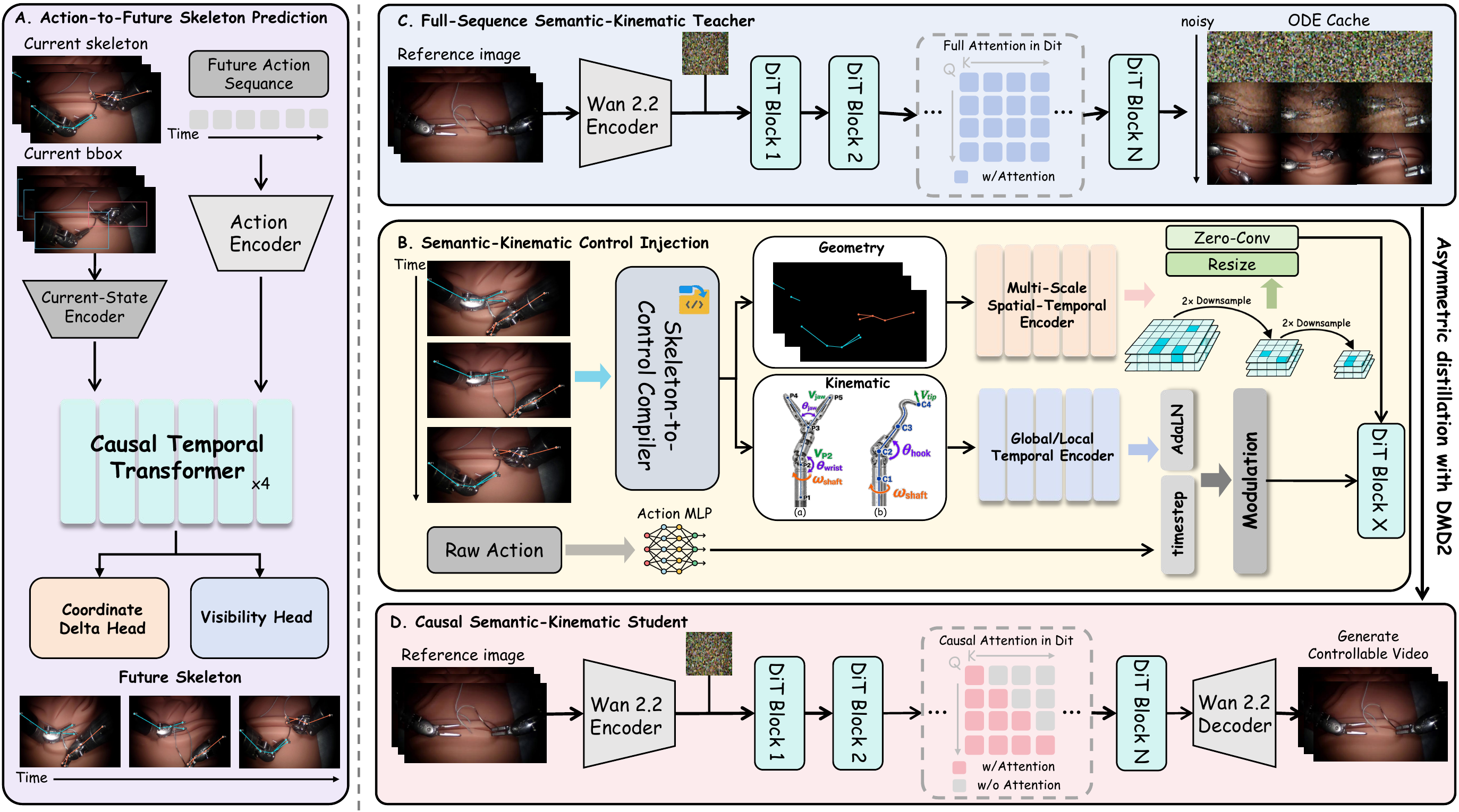Overview of the SurgCast pipeline