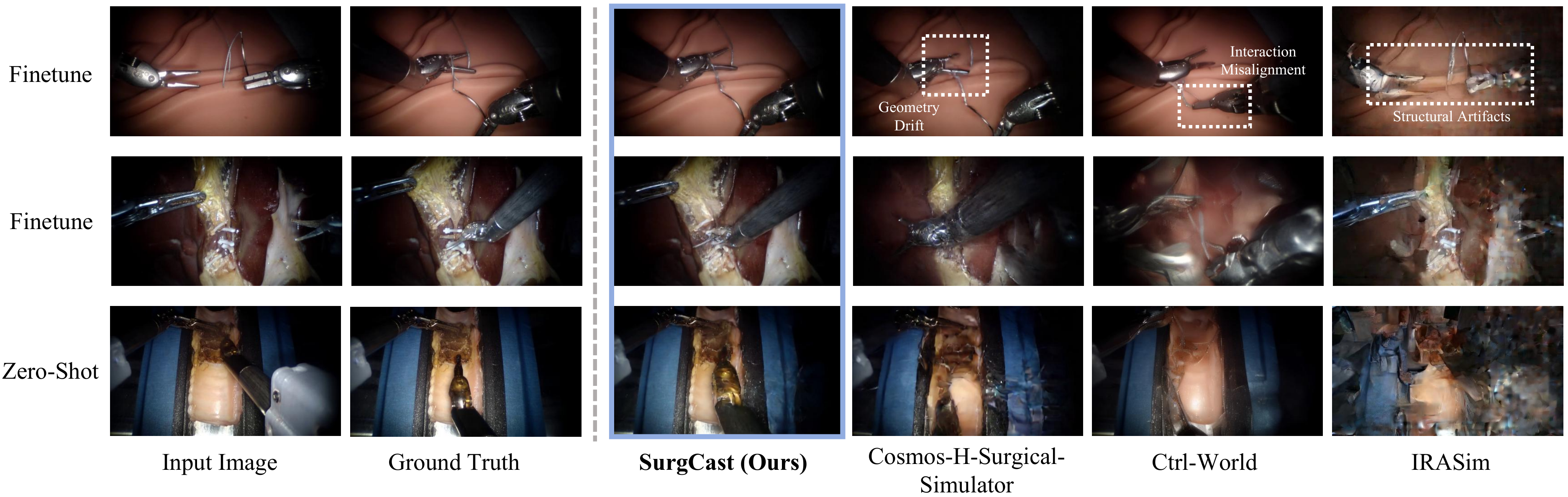 Qualitative comparison of SurgCast and baseline methods