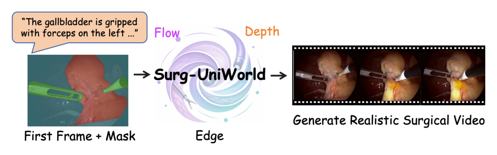 Surg-UniWorld: A Unified Surgical World Model with Multimodal Control Experts overview